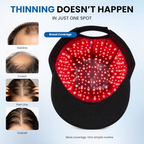 CAYAMA Laser Hair Growth Cap, 320 Lasers & LEDs, FDA-Cleared | 650nm red light; soft cap for men & women; up to 300 minutes per charge view 3