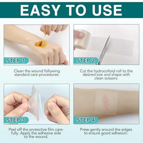 Hydrocolloid Roll for Wound Care (2IN X11.8FT), Medical Grade Self-Adhesive Hydrocolloid Patch Bandages for Wound Healing,Ultra-Thin & Waterproof, Scar Prevention, Burn Care view 7
