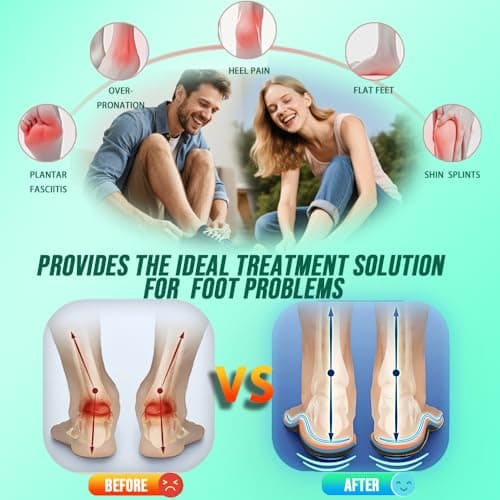 AOBEKOS Plantar Fasciitis Relief Insoles Men Women High Arch Support Shoe Inserts,240+lbs Comfort EVA Orthotics Insert Absorb Shock Work Boot Shoe Insole for Flat Feet, Pronation, Heel & Foot Pain view 2