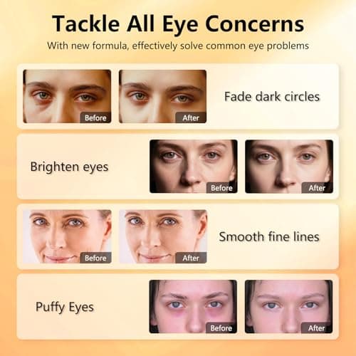 Under Eye Patches with Vitamin C & Caffeine 30 Pairs for Dark Circles, Fine Lines and Puffiness, with Niacinamide Hydra-Gel Collagen, Skin Care for Men & Women view 3