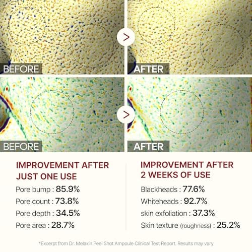 Dr.Melaxin Peel Shot Glow Black Rice Peeling Ampoule – AHA BHA Daily Chemical Exfoliant with Rice Water & Niacinamide, Glass Skin Texture for Dead Skin & Dull Complexion, Korean Skincare 2.7 fl.oz view 6