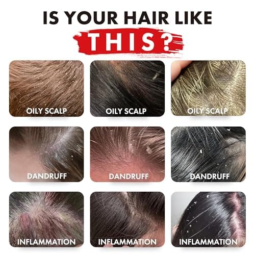 ALFHEIM Rosemary+ Purifying Shampoo & Conditioner Set Travel Size – Balancing Care for Oily & Fine Hair with Rosemary, Peppermint & Jojoba Oils – Deep Cleanse, Lightweight Hydration, Sulfate Free view 2