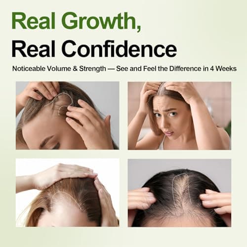 Hair Growth Oil Foam with Rosemary and Castor Oil Vegan Natural Formula for Thinning Hair Organic Plant Based Scalp Treatment Non Greasy Hair Regrowth Support for Men and Women 3 Bottles Each 2.11 oz view 6
