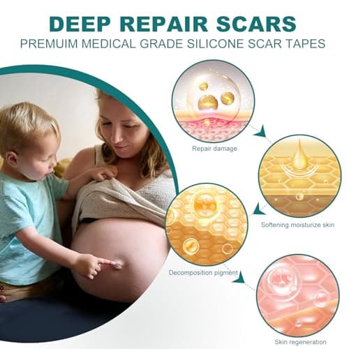 Silicone Scar Sheets (1.6"x 158" Roll-4M), Medical Grade Silicone Scar Tape view 5