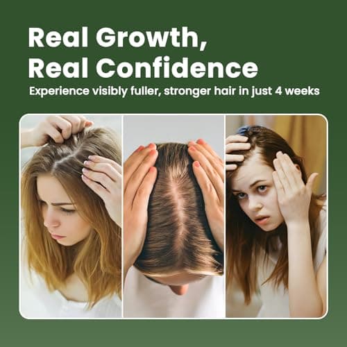 Hair Growth Oil with Rosemary Castor Oil Vegan Strengthening Formula for Thinning Hair Regrowth Treatment in Natural Vegan Hair Serum to Nourish Scalp Stimulate Follicles 3PCS for Man and Women view 5