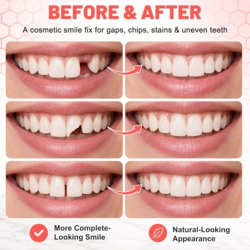 Dentures for Men and Women, Custom Upper & Lower Smile | Reusable False Teeth Cosmetic Smile Coverage, Silicone Veneers Teeth, Easy Use and Show Confident Smile in Minutes view 3