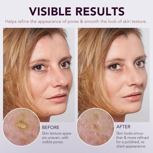 Peel Shot Glow Rice Ampoule Duo | Black Rice Exfoliant Face and Pore Cleaner with Hyaluronic Acid & Rice Extract Serum | Facial Pore Exfoliator, Peelshot Blackhead Dead Skin Remover for Face (100ml) view 6