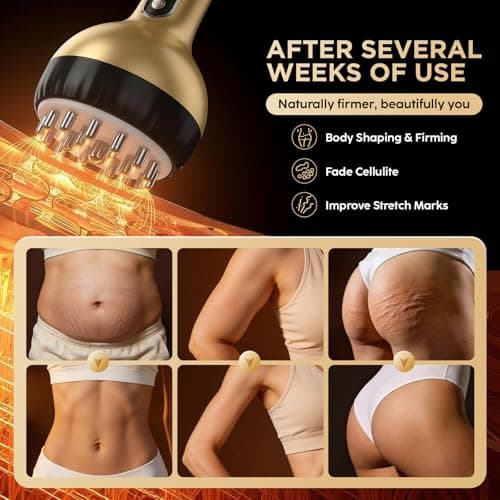 OVGIAP Lymphatic Drainage Massager & Anti-Cellulite Massage Tool (Gilded) | Body Sculpting Device for Legs, Arms & Stomach, Supports Smoother Skin, with Gentle Warming & Vibration view 5