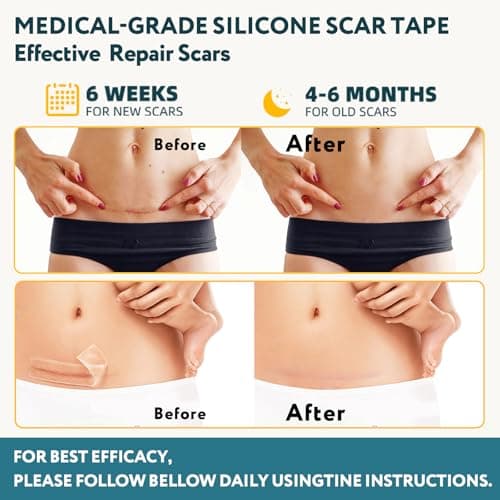 Silicone Scar Tape - 60" x 1.6" Roll - 1.5M, Scar Treatment for Improves Surgical, Keloid, Hypertrophic Scars - Medical Grade Reusable Silicone Scar Sheets view 3