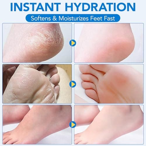 Uruses 2Pack Urea Cream 60% plus Salicylic Acid 2% Urea Foot Care Stick,Foot Cream for Foot Callus Remover, Feet Moisturizer Stick for Dry Cracked Heels, Hands, Knees,Hydrating Heel Balm, Easy To Use view 6