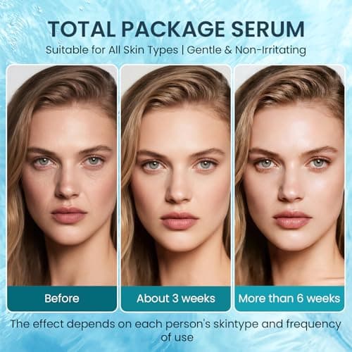 All-in-One Vitamin C Serum For Face With Hyaluronic Acid & Peptides – Anti-Aging, Dark Spot Corrector, Firming & Hydrating Treatment For Women & Men, Reduces Wrinkles & Fine Lines, 30ml (1 Fl Oz) view 4